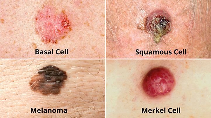 Changes in Moles